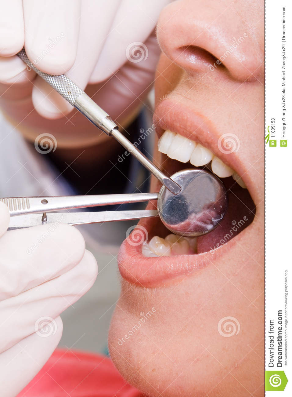 Free Dental Check Up