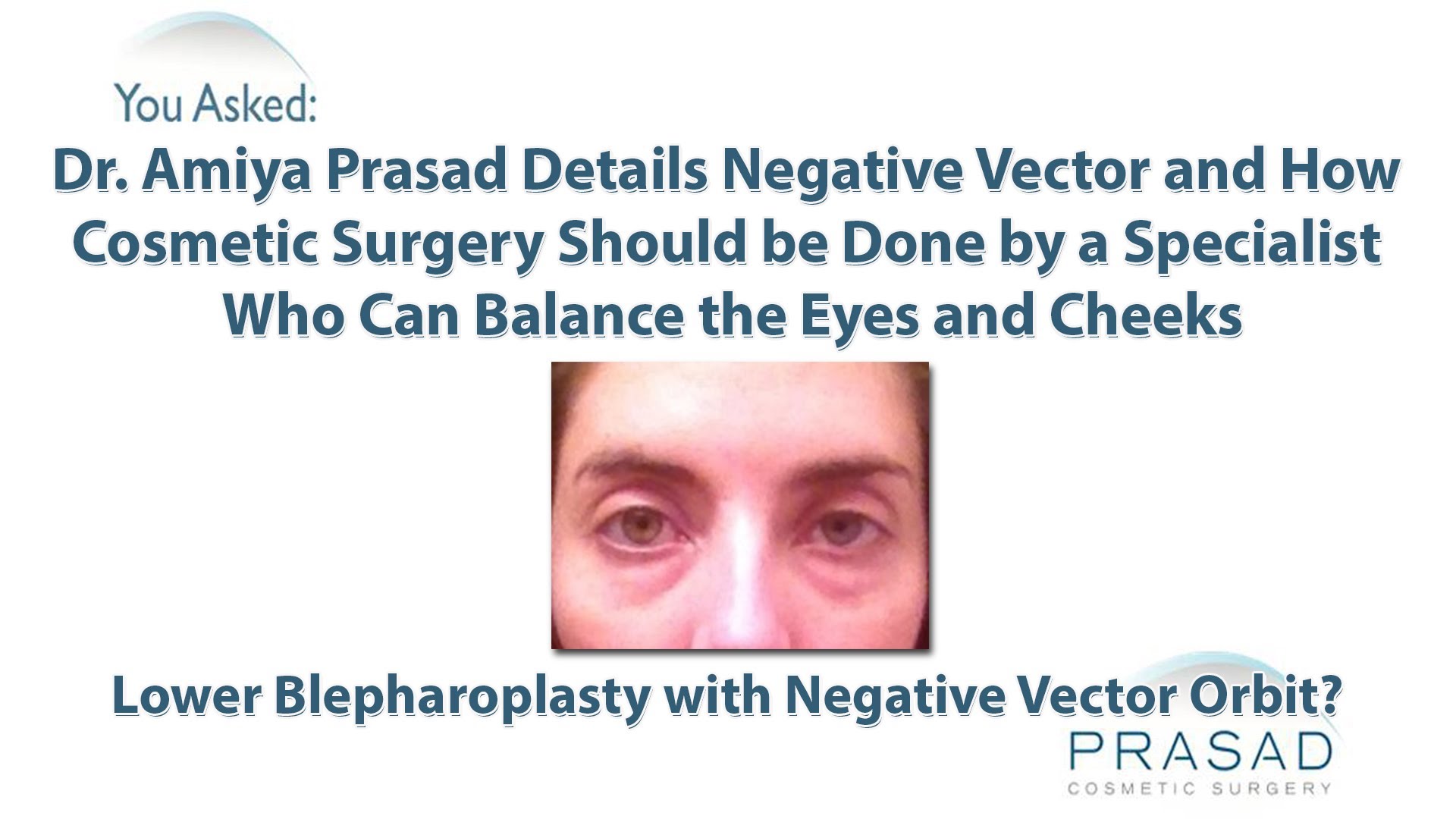 Blepharoplasty and Negative Vector