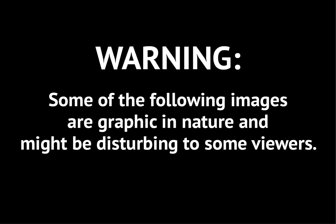 13 Warning Some Graphics Images