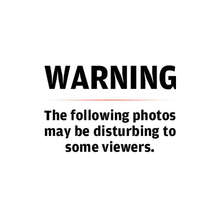 Some Images of the Following May Be Disturbing Warning Some Images of the Following May Be Disturbing Warning