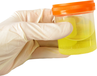 Urine Specimen Collection Clip Art