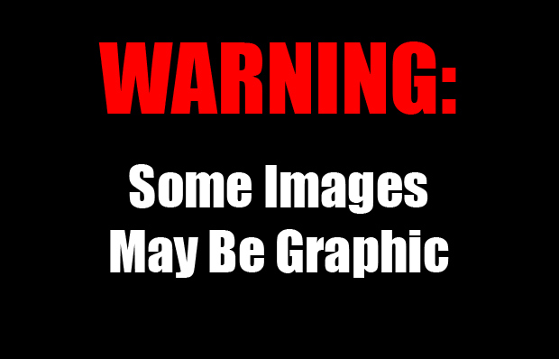 7 Warning Graphic Content Images