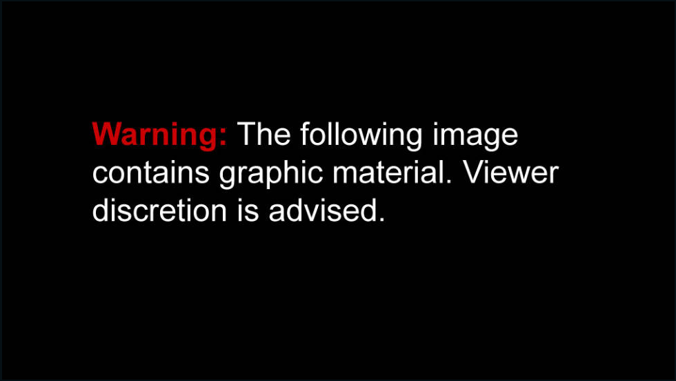 Warning Graphic Content Sign