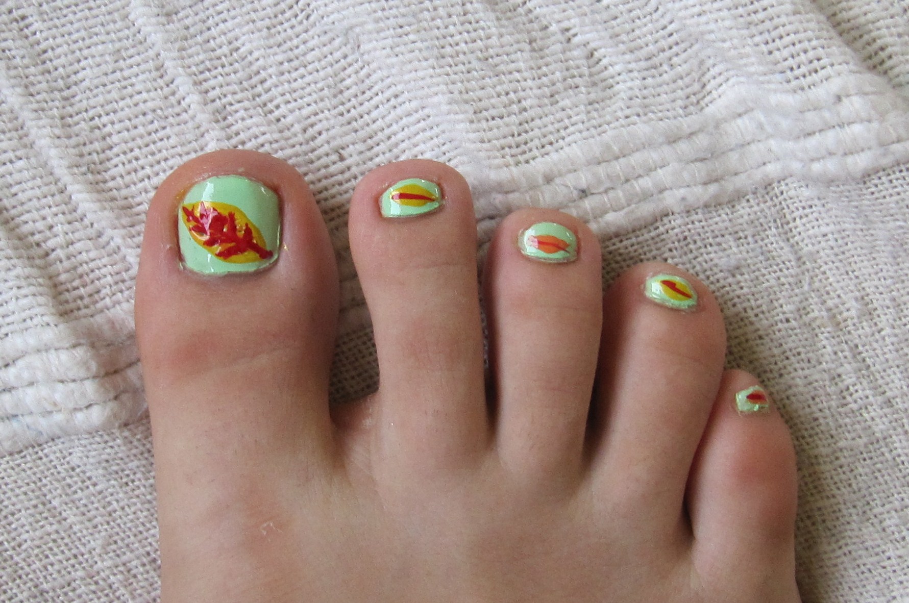 Dark Brown Line On Big Toe Nail Dark Brown Line On Big Toe Nail