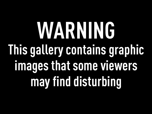 Warning Graphic Content Warning Graphic Content