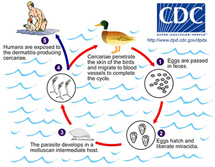 Swimmer's Itch Life Cycle