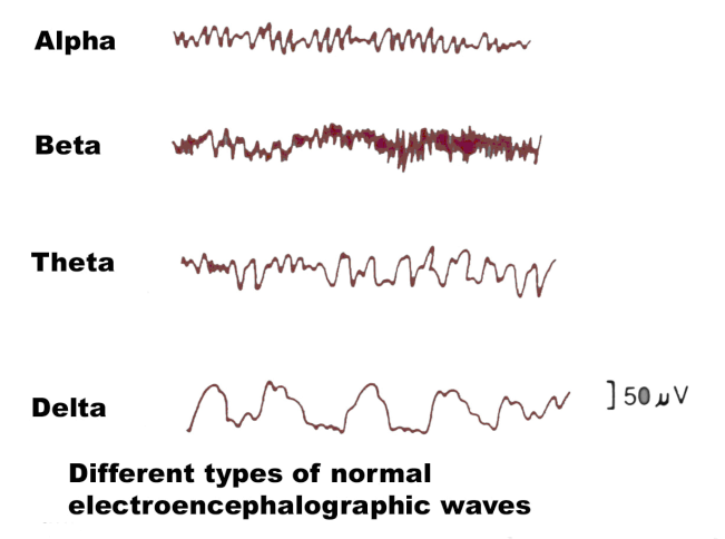 Different Types of Brain Waves